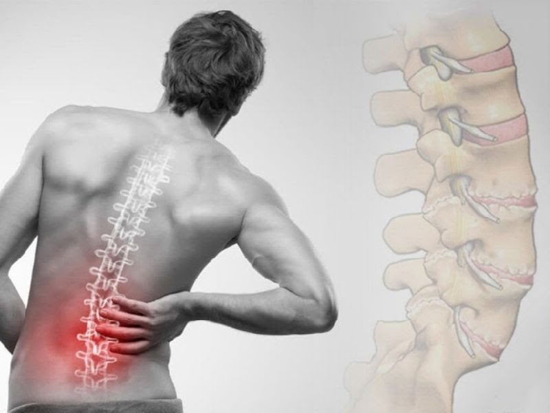 Các bệnh lý về cột sống là nguyên nhân phổ biến dẫn đến tình trạng đau ở vùng lưng dưới